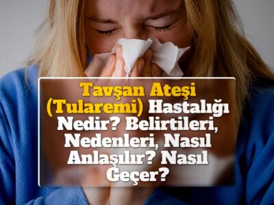 Tavşan Ateşi (Tularemi) Hastalığı Nedir? Belirtileri, Nedenleri, Nasıl Anlaşılır? Nasıl Geçer?